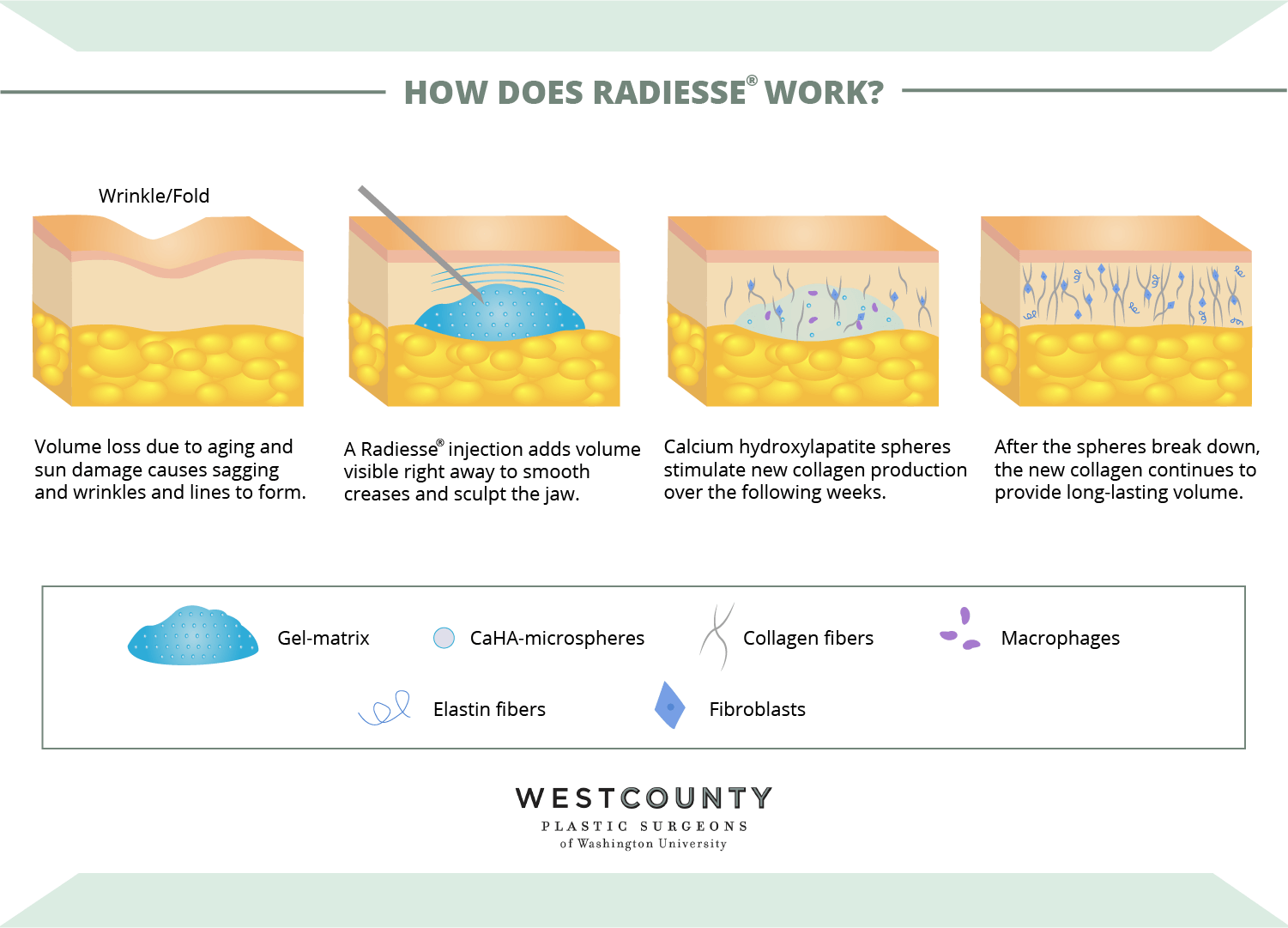Learn how Radiesse® at St. Louis’ West County Plastic Surgeons works.
