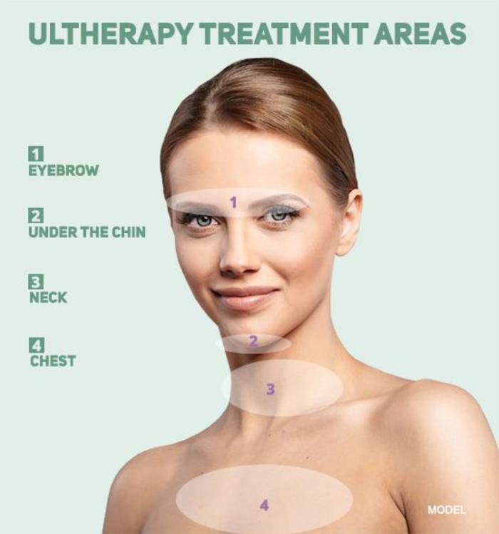 Learn more about treatment areas for Ultherapy<sup>®</sup> in St. Louis