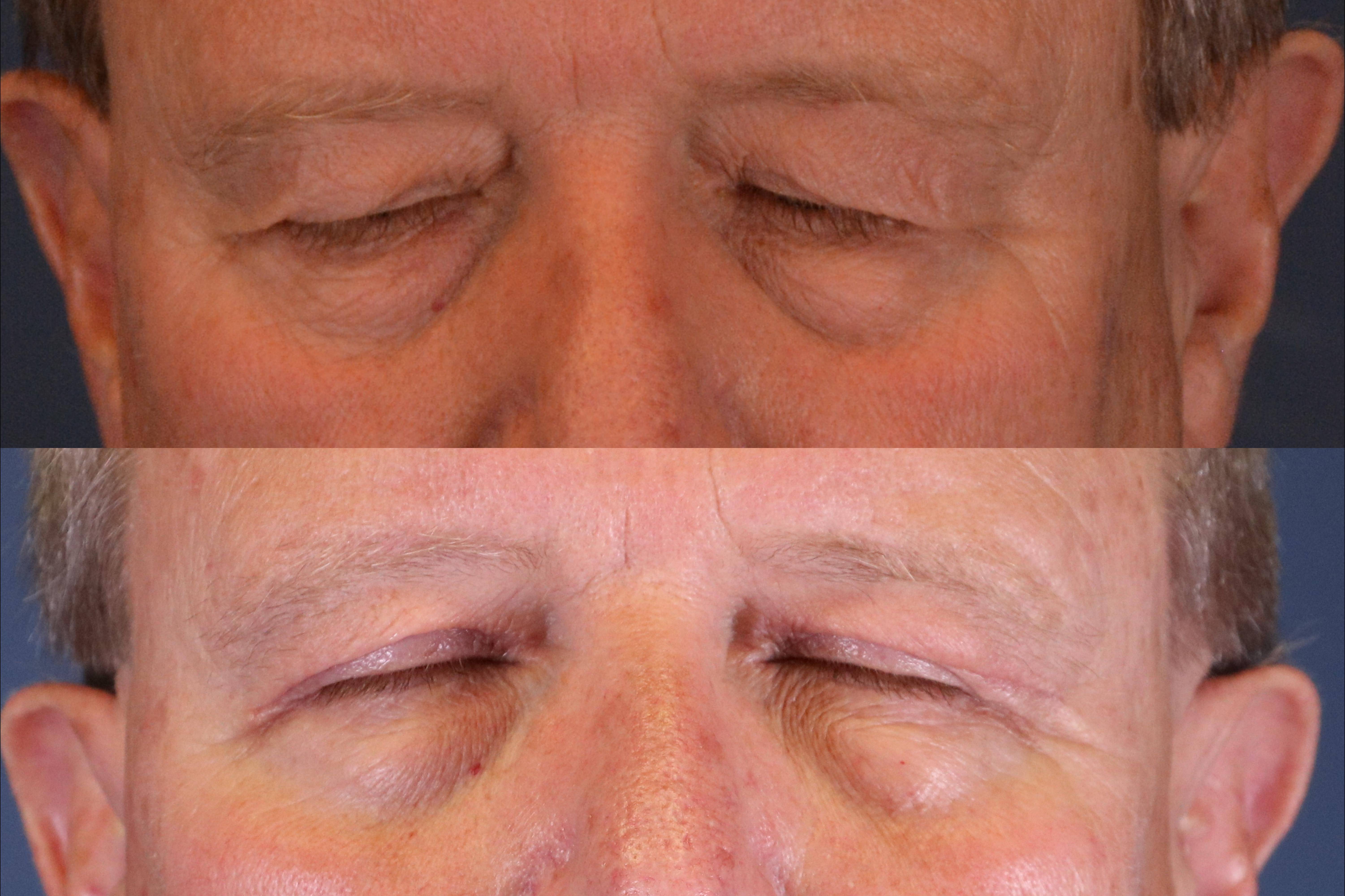 Front Closed image
