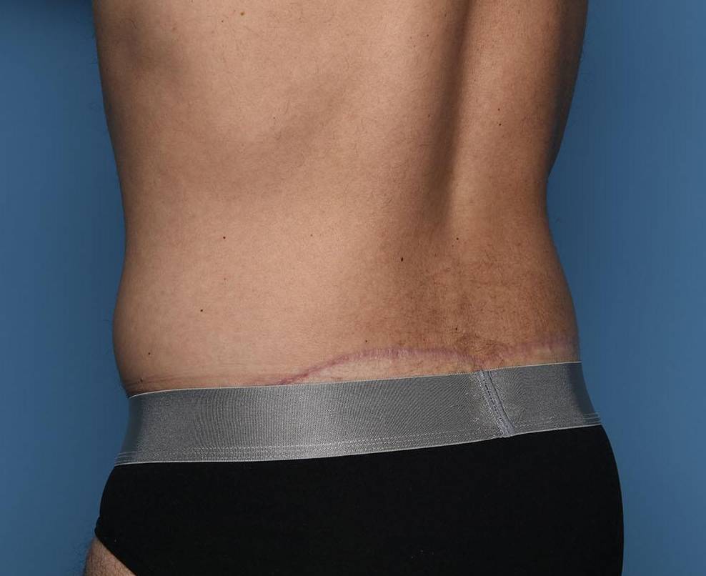 Rear Left View After thumbnail