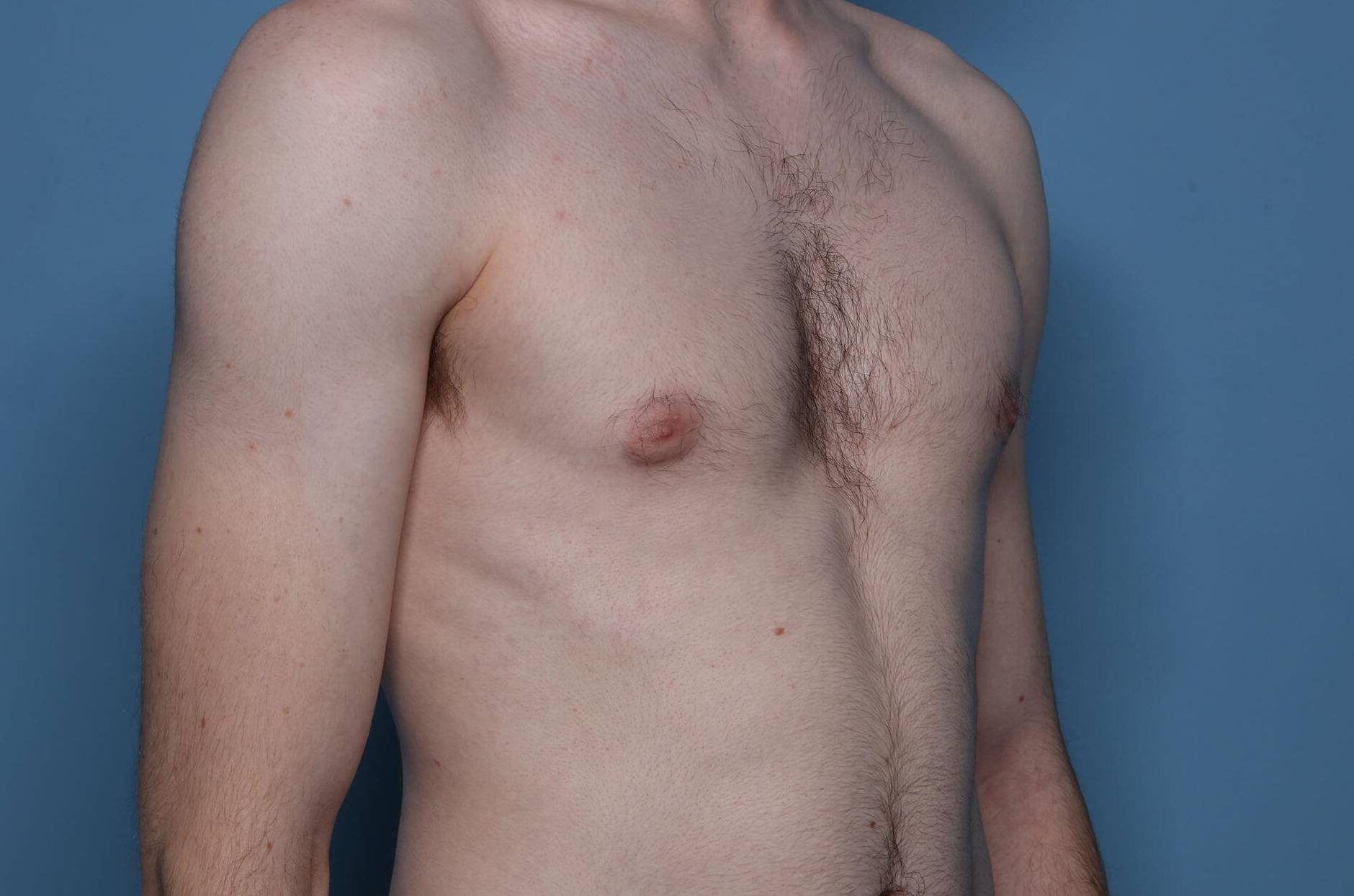 3/4 Right View After thumbnail
