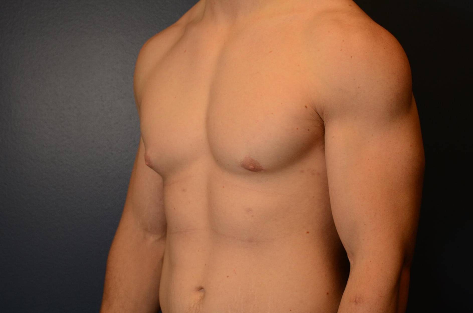 3/4 Left View Before thumbnail