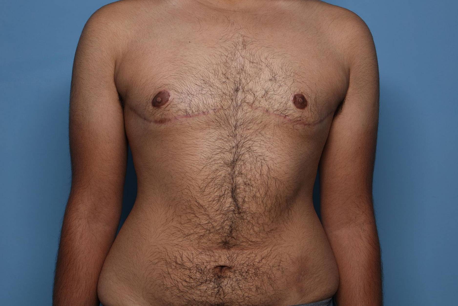 After image