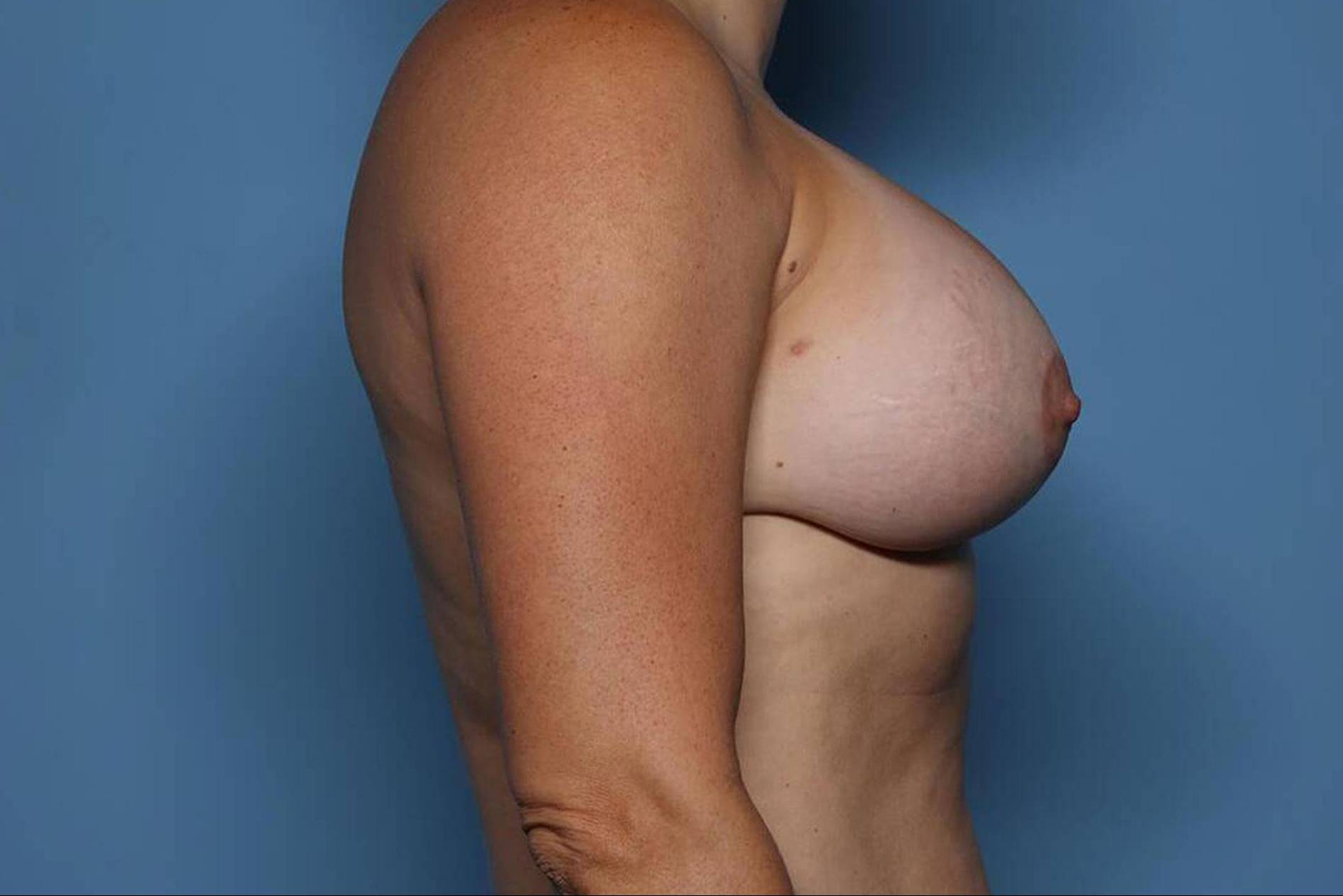 Right View After thumbnail