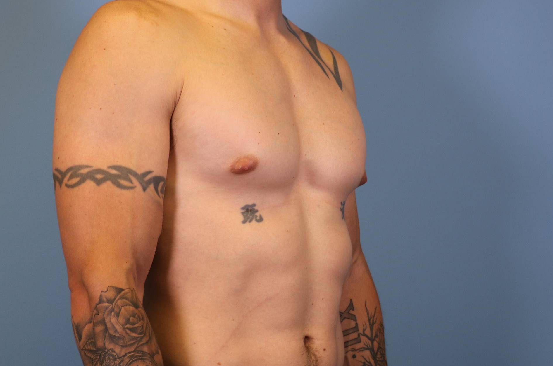 3/4 Right View Before thumbnail