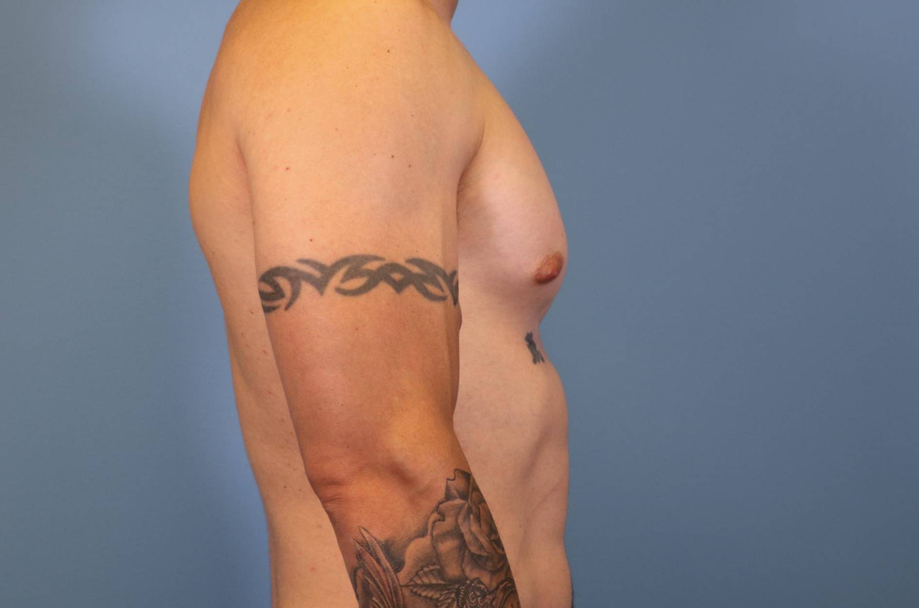 Right View Before thumbnail