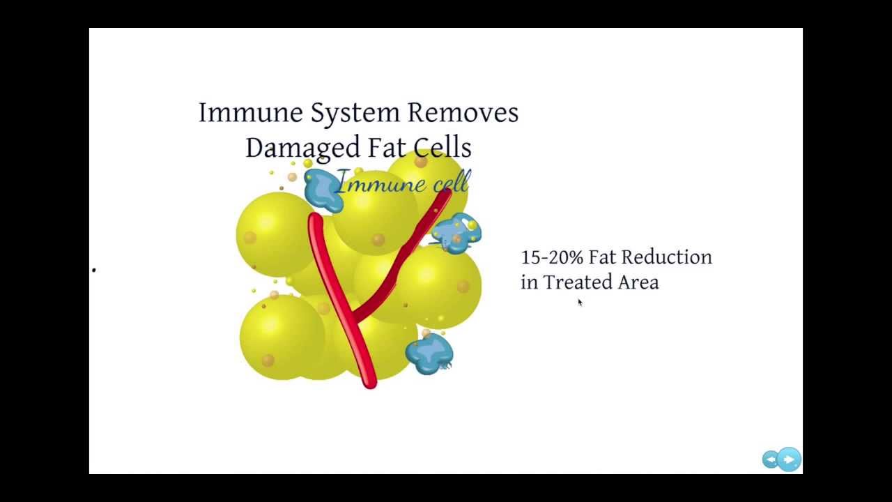 West County Plastic Surgeons CoolSculpting: Freeze Away the Fat