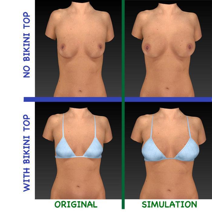 BREAST-SCULPTOR-LOW-RES-PICS